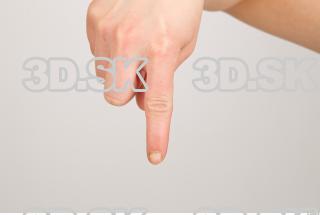 Finger texture of Pat 0003